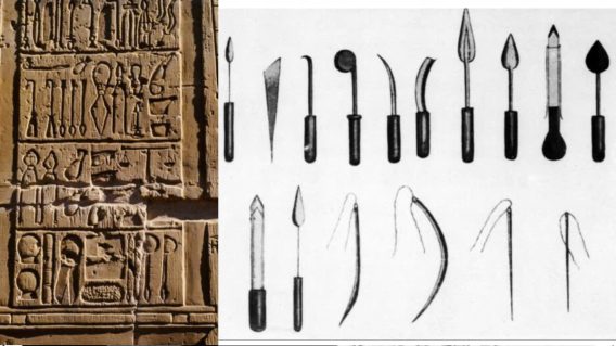 Lich Su Ra Doi Dung Cu Phau Thuat 4